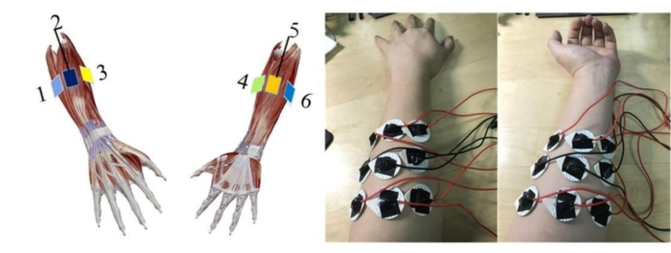 this shows an arm covered in electrodes